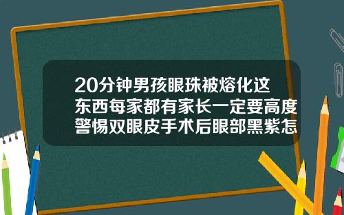 20分钟男孩眼珠被熔化这东西每家都有家长一定要高度警惕双眼皮手术后眼部黑紫怎么办